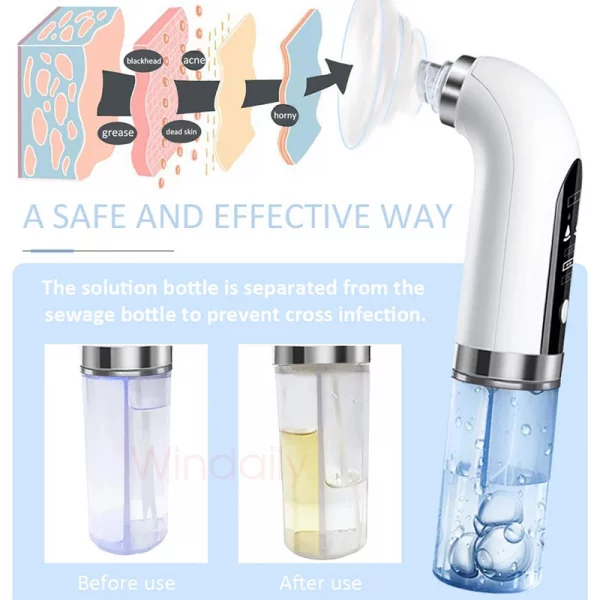2023 Blackhead Remover Pore Vacuum Cleaner Electric Micro Small Bubble Facial Cleasing Machine USB Rechargeable Beauty Device – Bild 4
